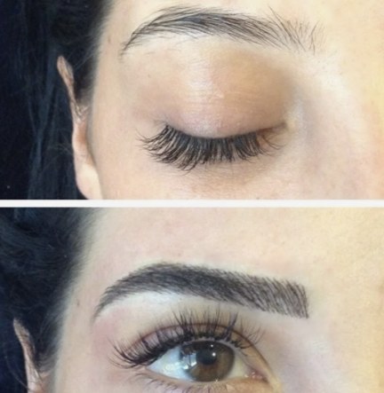 Before-and-after eyebrow definition